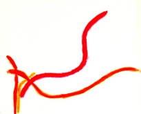 1987 Fig 2 Arms Rebound